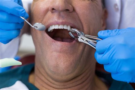 oral surgery a2 dental