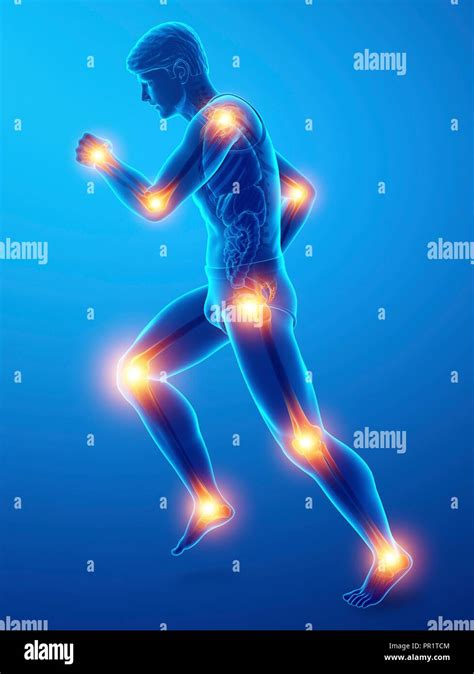 Man With Joint Pain Computer Illustration Stock Photo Alamy
