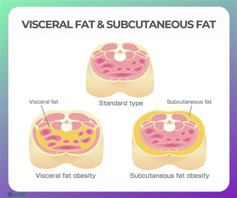 Visceral Fat Why Is Visceral Fat Dangerous To You And 12 Tips To Get