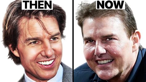 Tom Cruise Why His Face Looks Different Plastic Surgery Analysis Oasis Medical Aesthetics
