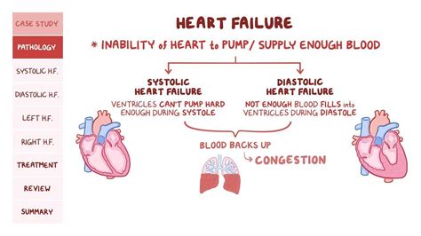 Heart Failure Pathology Review Osmosis