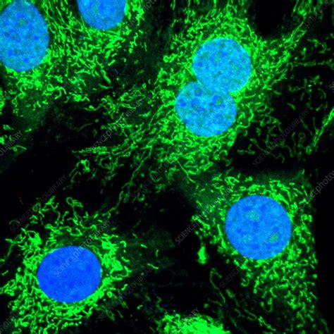 Hela Cells Light Micrograph Stock Image G4420476 Science Photo