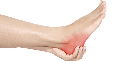 Heel Pain In Young Athletes A Warning Sign Dbn Blog