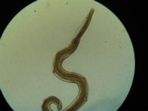 Enterobius Vermicularis Female Sam Flickr