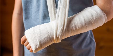 A Promising New Strategy To Help Broken Bones Heal Faster Lab Manager