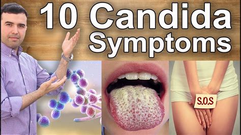 Candida Symptoms Feet