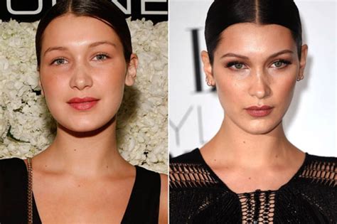 bella hadid nose job before and after plastic surgery magazine
