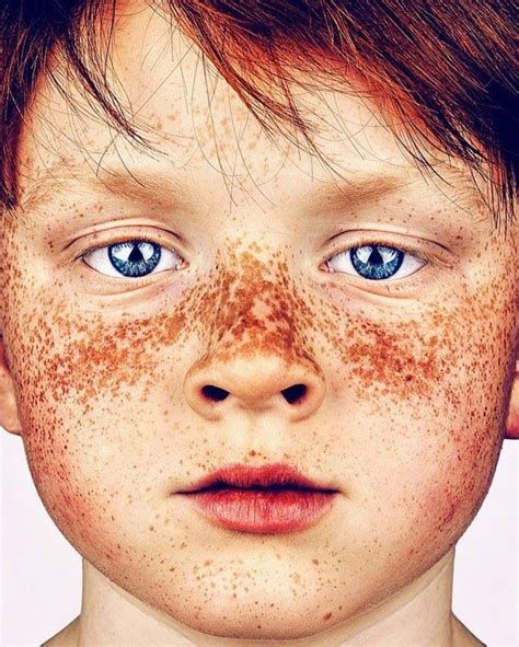 Pin By Tatiana On Kids People With Freckles Freckles Beauty