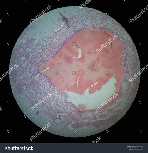 Histology Specimen Human Umbilical Cord Under Stock Photo 1648989148