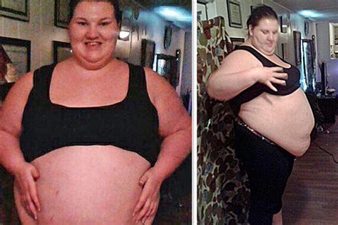 Obese Woman Who Gorged On A Day Loses St After Having Gastric Bypass Surgery Daily Star