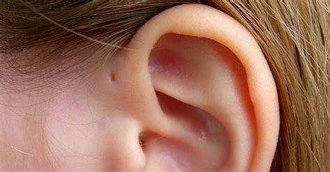 Lumps Nodules And Cysts Around The Ears The Clifford Clinic