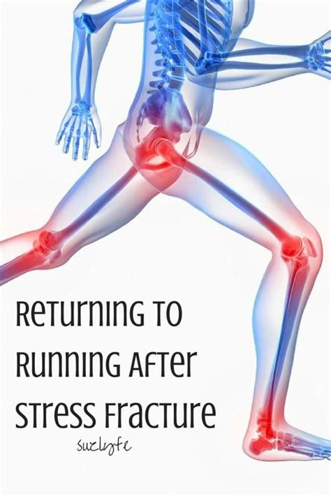 Returning To Running After Stress Fracture Suzlyfe Stress Fracture