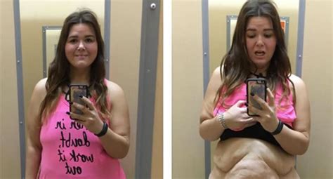 Woman Shares Honest Photos Of 180 Pound Weight Loss