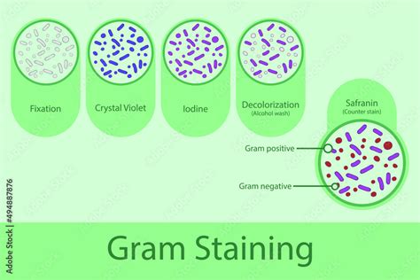 Diagram Showing Gram Staining Technique Steps Microbiology Laboratory