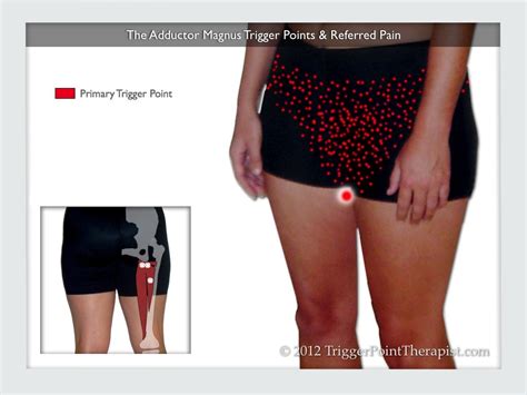 Adductor Trigger Points The Pms Trigger Point