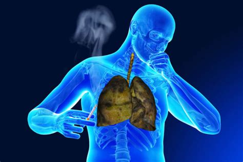 What Causes Smokers Cough How To Stop Coughing Up Mucus