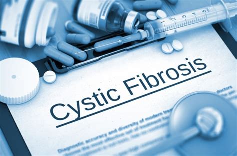 Cystic Fibrosis Testing What Are The Options And Their Effectiveness
