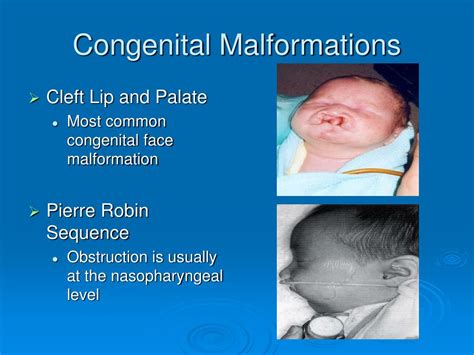 Ppt The Neonatal Airway And Neonatal Intubation Powerpoint