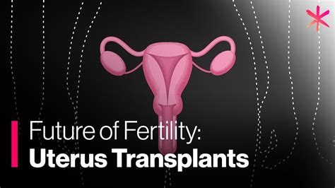 Uterus Transplants A Step Closer To Overcoming Infertility Youtube
