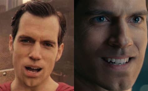 Zack Snyder Breaks Silence On Supermans Deformed Mouth In 2017s