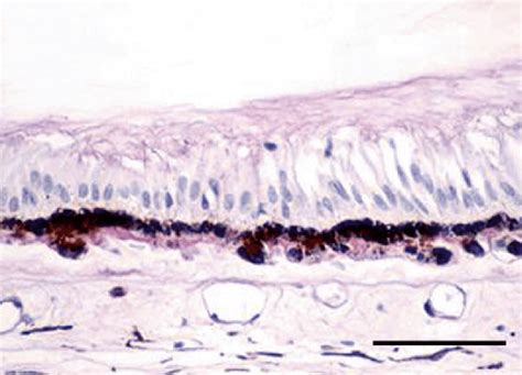 15 Ora Serrata The Non Pigmented Ciliary Epithelium Transform To