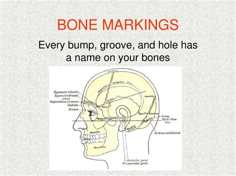 Ppt Bone Markings Powerpoint Presentation Free Download Id1219370