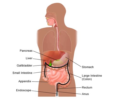 Colon And Rectal Cancer Ui Health
