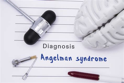 10 Symptoms Of Angelman Syndrome Facty Health