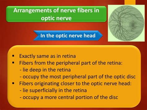 Anatomy Of Optic Nerve Optic Nerve Anatomy Blood Supply And Clinical