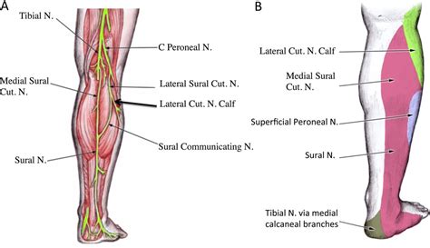 Entrapment Of The Lateral Cutaneous Nerve Of The Calf Bmj Case Reports