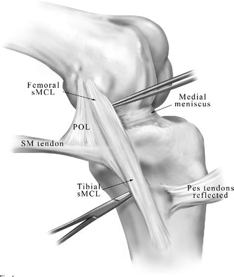 Pdf The Anatomy Of The Medial Part Of The Knee Semantic Scholar