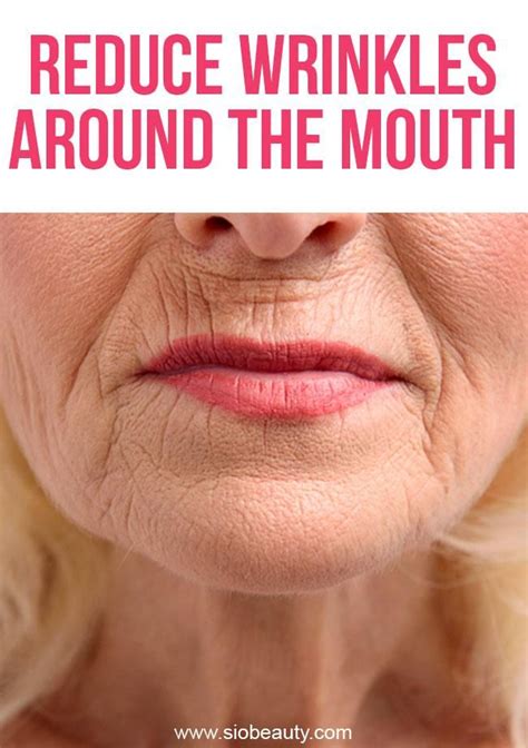 How To Treat Wrinkles Around The Mouth Smokers Lines How To Line