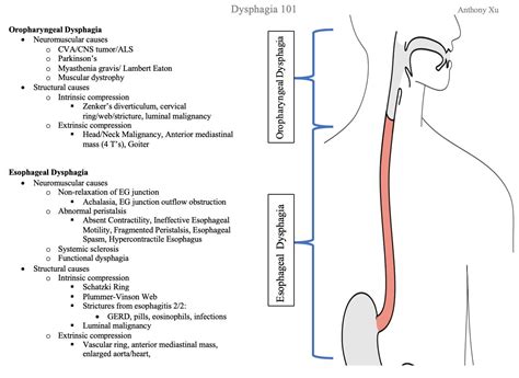 Oropharyngeal And Esophageal Causes Of Dysphagia Grepmed