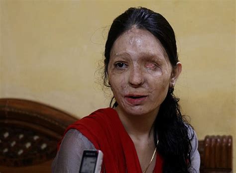 The Acid Attack Survivor Who Walked The Ramp In New York Get Ahead