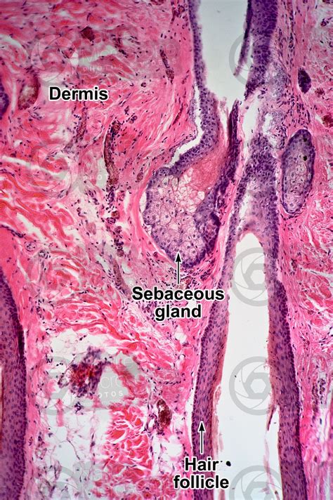 Man Sebaceous Gland Vertical Section 125x Sebaceous Gland