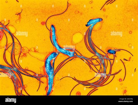 Spirochete Bacteria Coloured Transmission Electron Micrograph Tem