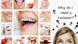 How Much Do Braces Cost With Insurance For Adults Pictures