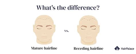 mature hairline everything you need to know