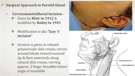 Surgical Anatomy Of Major Salivary Glands