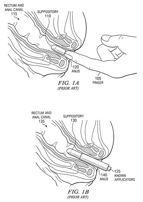 How do you insert a tampon? Patent US20100087797 - Method and apparatus for inserting a rectal suppository - Google Patents