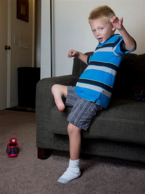Video Father Asks That 4 Year Old Sons Stolen Prosthetic Leg Be