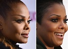 Janet Jackson's Plastic Surgery: Her Several Cosmetic Procedures