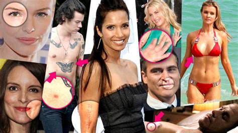 Body Oddities Celebrities With Physical Deformities