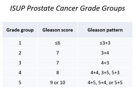Prostate Cancer Staging Radiology Reference Article Radiopaedia Org