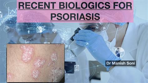 Video Whats New In Treatment Of Psoriasis Recent Biologics For