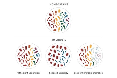Image Showing Homeostatis In The Gut Bacteria Versus Dybiosis
