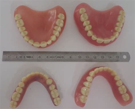 Full Dentures Dental