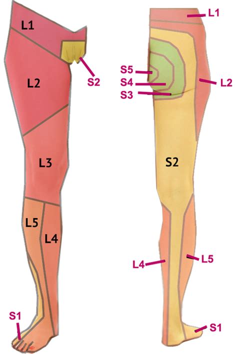 Dermatomes Of The Lower Body Health Sciatica Cervical Spinal