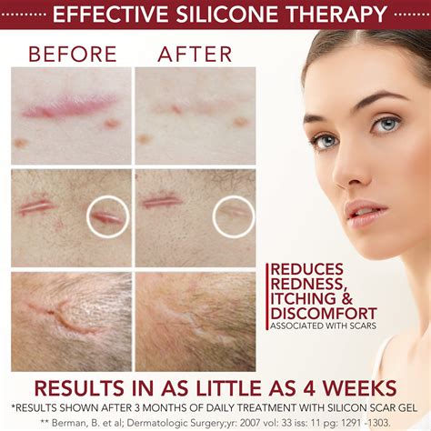 Physician Formulated Silicone Scar Gel Advanced Crosspolymer Medical Grade Scar Cream For Face