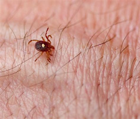 All About The Lone Star Tick Which Is Giving People Red Meat Allergies